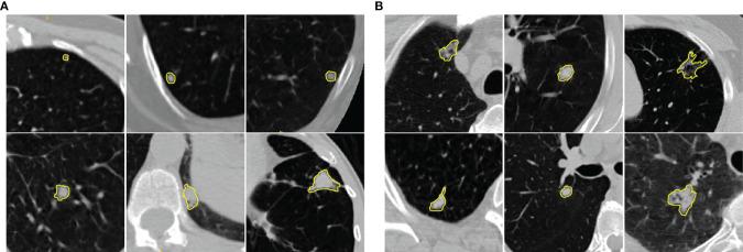 https://cdn.ncbi.nlm.nih.gov/pmc/blobs/8a02/8718670/1bb83a8686a8/fonc-11-737368-g001.jpg