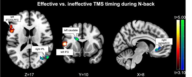 https://cdn.ncbi.nlm.nih.gov/pmc/blobs/8a03/11420068/ad3e7d712f8c/41380_2024_2535_Fig3_HTML.jpg