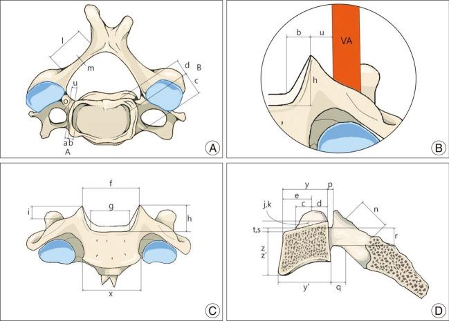 https://cdn.ncbi.nlm.nih.gov/pmc/blobs/8a13/3393857/21934e0362ad/jkns-51-247-g002.jpg