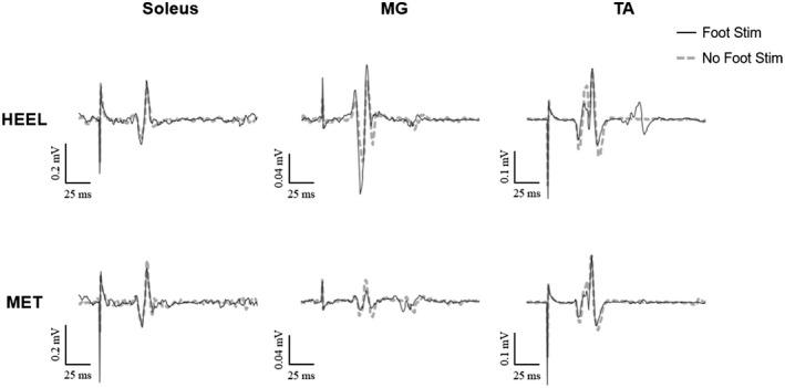https://cdn.ncbi.nlm.nih.gov/pmc/blobs/8a13/9249991/26487c1a2eab/PHY2-10-e15240-g001.jpg