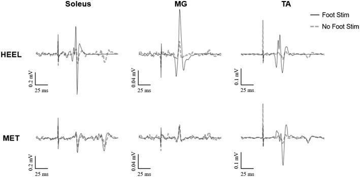 https://cdn.ncbi.nlm.nih.gov/pmc/blobs/8a13/9249991/445ef838a8b6/PHY2-10-e15240-g007.jpg
