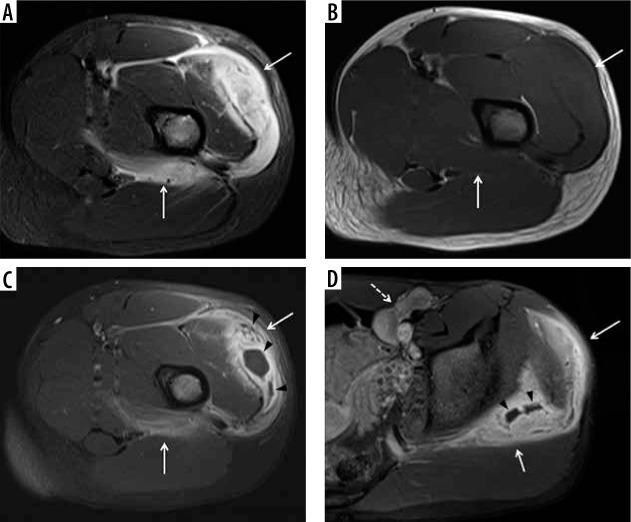 https://cdn.ncbi.nlm.nih.gov/pmc/blobs/8a22/9047866/0bc7851bd280/PJR-87-46472-g003.jpg