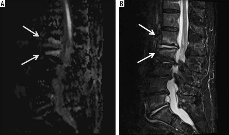 https://cdn.ncbi.nlm.nih.gov/pmc/blobs/8a22/9047866/2b91bdb97d31/PJR-87-46472-g012.jpg
