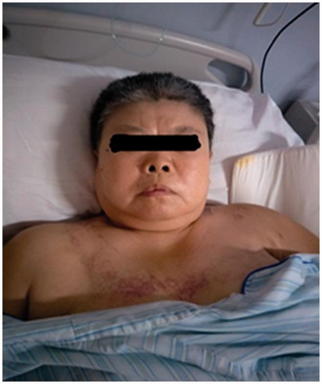 https://cdn.ncbi.nlm.nih.gov/pmc/blobs/8a26/8258760/4c67be260dd6/10.1177_03000605211028420-fig1.jpg