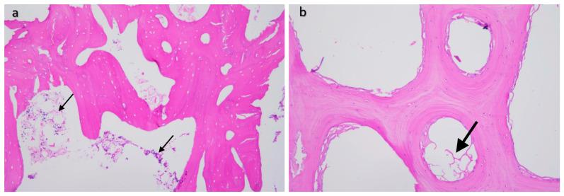 https://cdn.ncbi.nlm.nih.gov/pmc/blobs/8a28/10223620/8dc84c487d10/materials-16-03861-g011.jpg