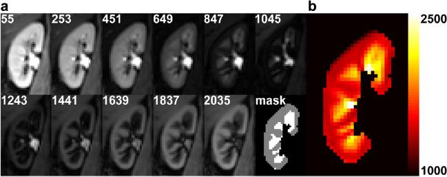 https://cdn.ncbi.nlm.nih.gov/pmc/blobs/8a2c/10791848/56bb7e63f976/330_2023_10281_Fig3_HTML.jpg