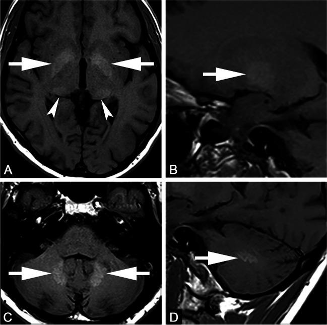 https://cdn.ncbi.nlm.nih.gov/pmc/blobs/8a2c/10791848/6ff683b83500/330_2023_10281_Fig1_HTML.jpg