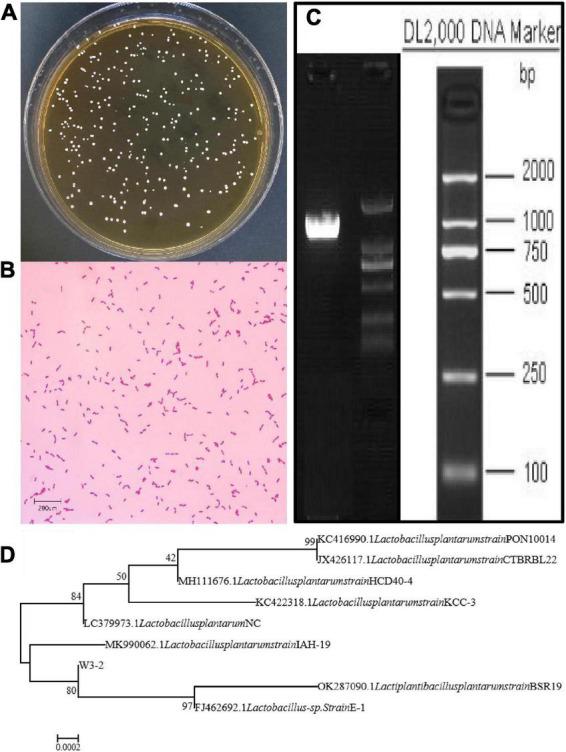 https://cdn.ncbi.nlm.nih.gov/pmc/blobs/8a30/9872010/3417b66efeb5/fnut-09-1111880-g002.jpg