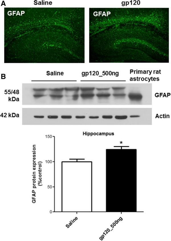 https://cdn.ncbi.nlm.nih.gov/pmc/blobs/8a32/4046047/81d50a68ffe6/1742-2094-11-91-2.jpg