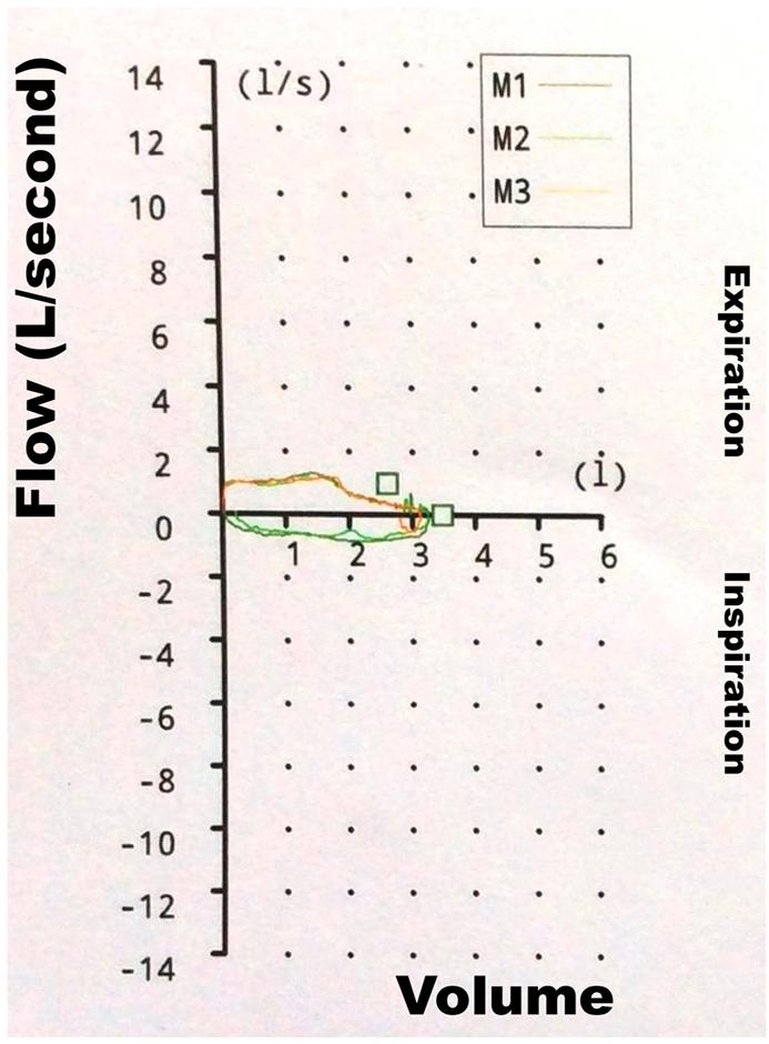 https://cdn.ncbi.nlm.nih.gov/pmc/blobs/8a35/7113432/cc61661653f4/gr1.jpg