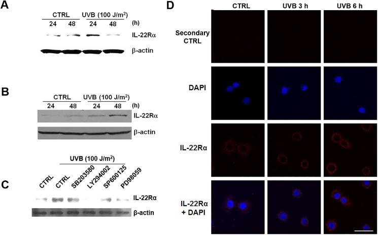 https://cdn.ncbi.nlm.nih.gov/pmc/blobs/8a38/5448782/20abcab7a0fc/pone.0178567.g002.jpg