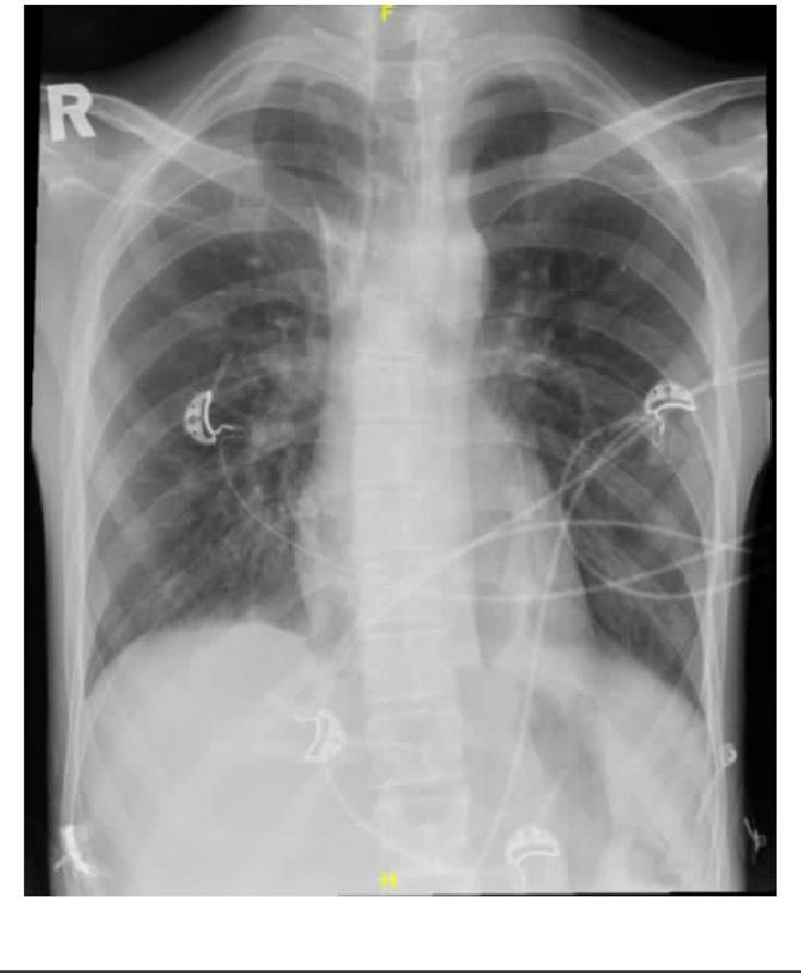 https://cdn.ncbi.nlm.nih.gov/pmc/blobs/8a4c/8149212/98ccac8a6f94/IMCRJ-14-339-g0001.jpg