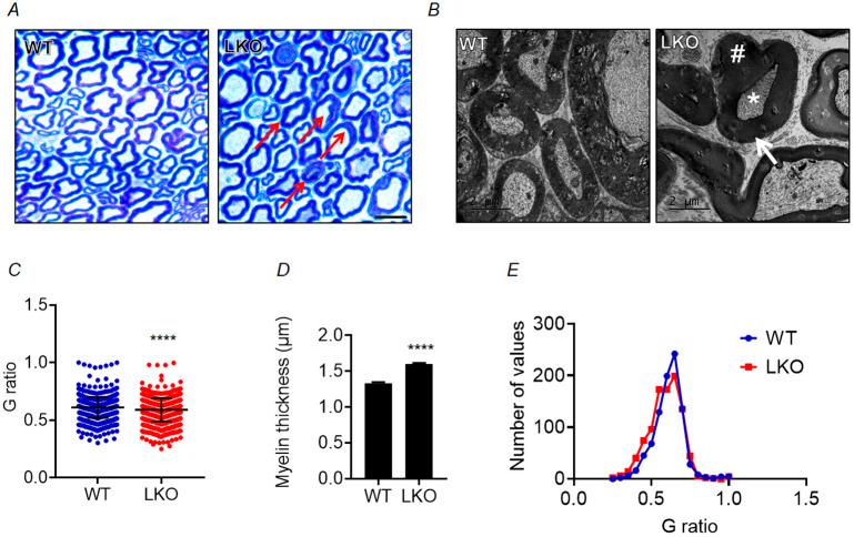 https://cdn.ncbi.nlm.nih.gov/pmc/blobs/8a4d/11512103/af964ddb7a7b/dmm-17-050905-g6.jpg