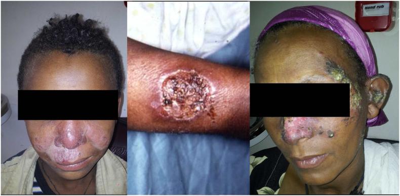 https://cdn.ncbi.nlm.nih.gov/pmc/blobs/8a4d/6537575/00ad27f5e5b3/gr2.jpg