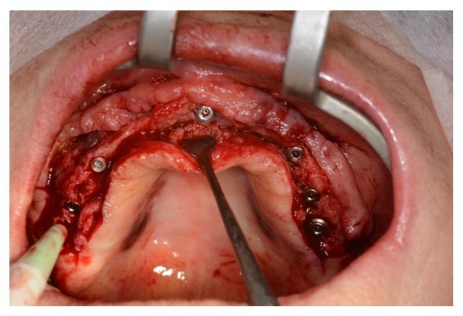 https://cdn.ncbi.nlm.nih.gov/pmc/blobs/8a5b/4620258/62a6a9128156/IJBM2015-121286.008.jpg