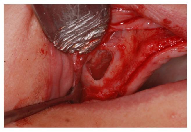 https://cdn.ncbi.nlm.nih.gov/pmc/blobs/8a5b/4620258/e318a105907b/IJBM2015-121286.004.jpg