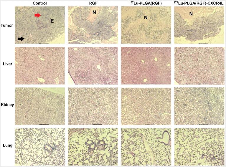 https://cdn.ncbi.nlm.nih.gov/pmc/blobs/8a61/10292846/54293bc94d16/fmed-10-1191315-g014.jpg