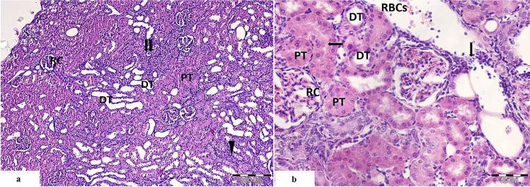 https://cdn.ncbi.nlm.nih.gov/pmc/blobs/8a63/10803452/e1b8060088b2/12011_2023_3742_Fig3_HTML.jpg
