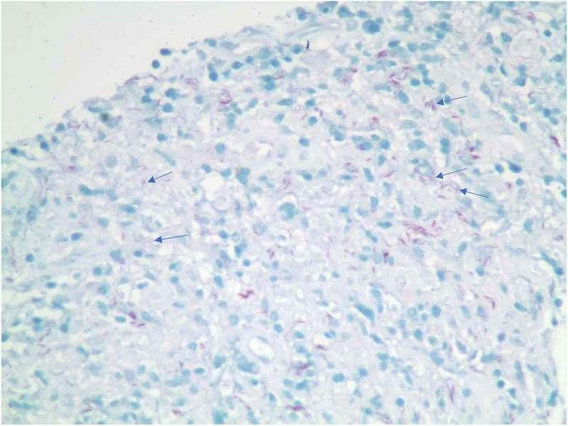 https://cdn.ncbi.nlm.nih.gov/pmc/blobs/8a64/6292348/3c0dfa314c4d/ZJCH_A_1539057_F0005_OC.jpg