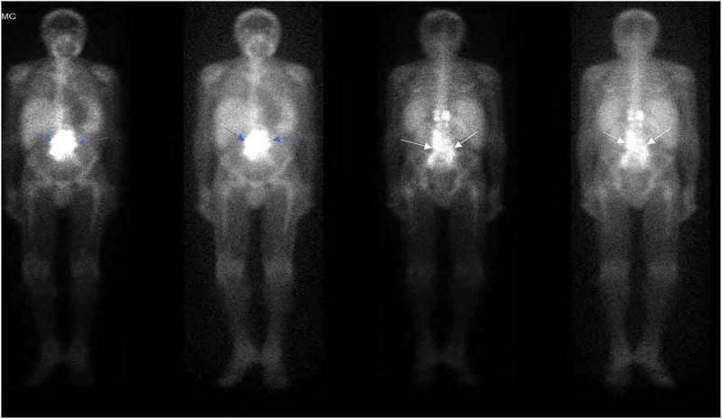 https://cdn.ncbi.nlm.nih.gov/pmc/blobs/8a64/6292348/c8828240f3f5/ZJCH_A_1539057_F0003_OC.jpg