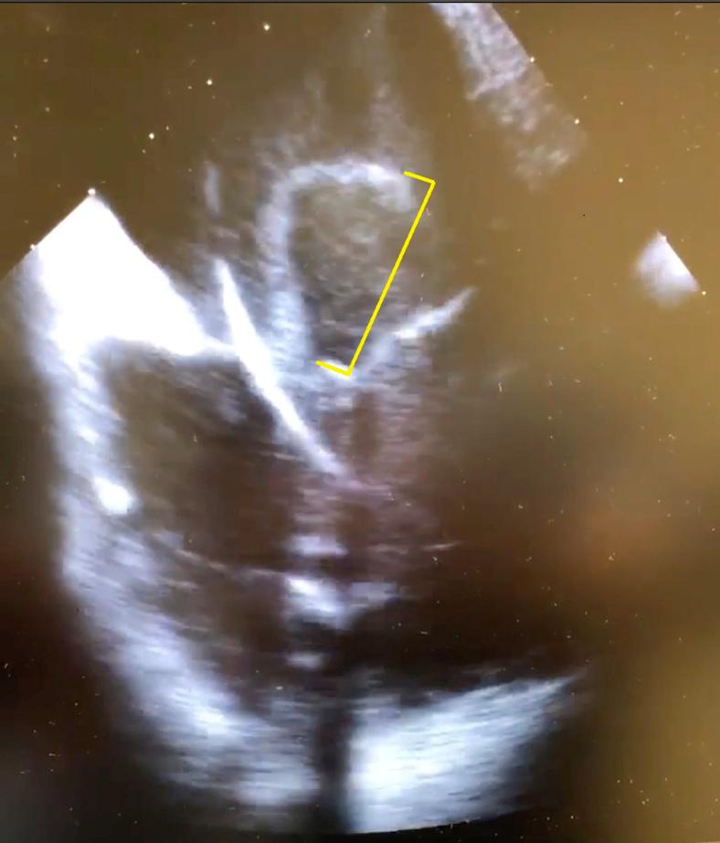 https://cdn.ncbi.nlm.nih.gov/pmc/blobs/8a6a/7987925/9d3720d30b36/gr2.jpg