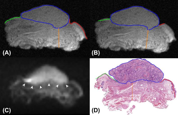 https://cdn.ncbi.nlm.nih.gov/pmc/blobs/8a72/7496932/f04c877b0402/HED-42-2039-g005.jpg