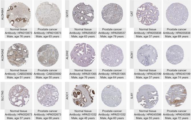 https://cdn.ncbi.nlm.nih.gov/pmc/blobs/8a79/12076229/2b7c53fb1c81/tau-14-04-1082-f12.jpg