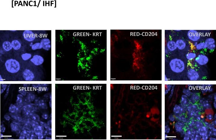 https://cdn.ncbi.nlm.nih.gov/pmc/blobs/8a7b/5619717/128173ffd77c/pone.0184451.g009.jpg