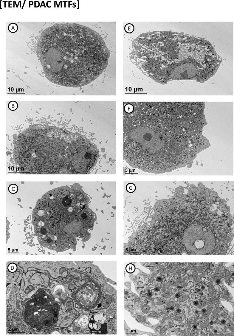 https://cdn.ncbi.nlm.nih.gov/pmc/blobs/8a7b/5619717/a7a4f0b3a992/pone.0184451.g006.jpg