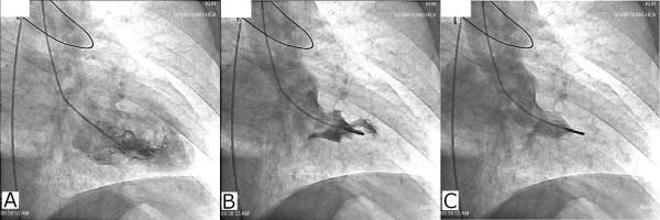 https://cdn.ncbi.nlm.nih.gov/pmc/blobs/8a87/3874663/bf5a7f75a55a/1756-0500-6-478-3.jpg