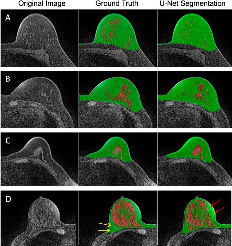 https://cdn.ncbi.nlm.nih.gov/pmc/blobs/8a98/8455741/7c6de10e5ded/10278_2021_472_Fig4_HTML.jpg