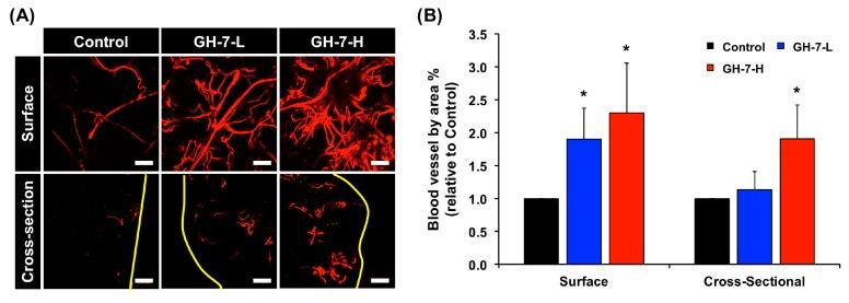 https://cdn.ncbi.nlm.nih.gov/pmc/blobs/8aa0/5578095/b80c2a2d6fd2/ijms-18-01705-g004.jpg