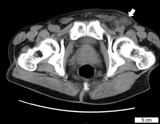 https://cdn.ncbi.nlm.nih.gov/pmc/blobs/8aa6/9647331/289f564645c0/gr1.jpg