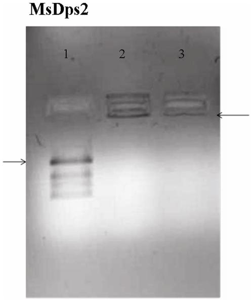 https://cdn.ncbi.nlm.nih.gov/pmc/blobs/8aa7/2779847/8c2112a28c38/pone.0008017.g001.jpg