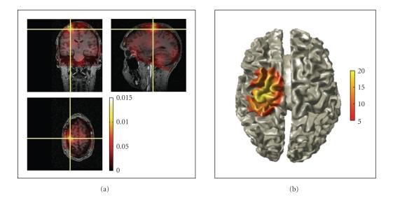 https://cdn.ncbi.nlm.nih.gov/pmc/blobs/8ab2/3021840/64aa1a0623f5/CIN2011-156869.006.jpg