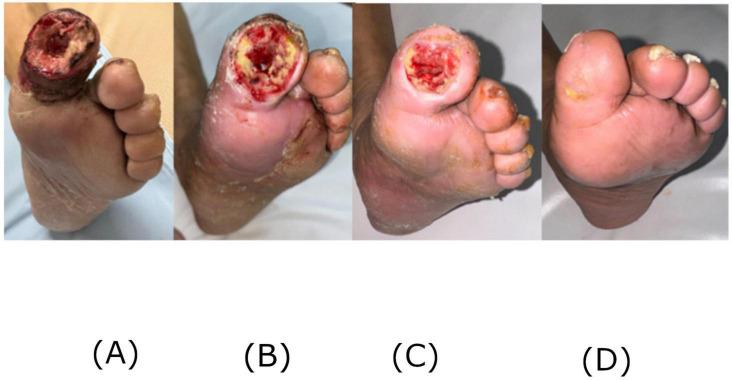 https://cdn.ncbi.nlm.nih.gov/pmc/blobs/8ab5/12283997/55db59042366/fmed-12-1568144-g001.jpg