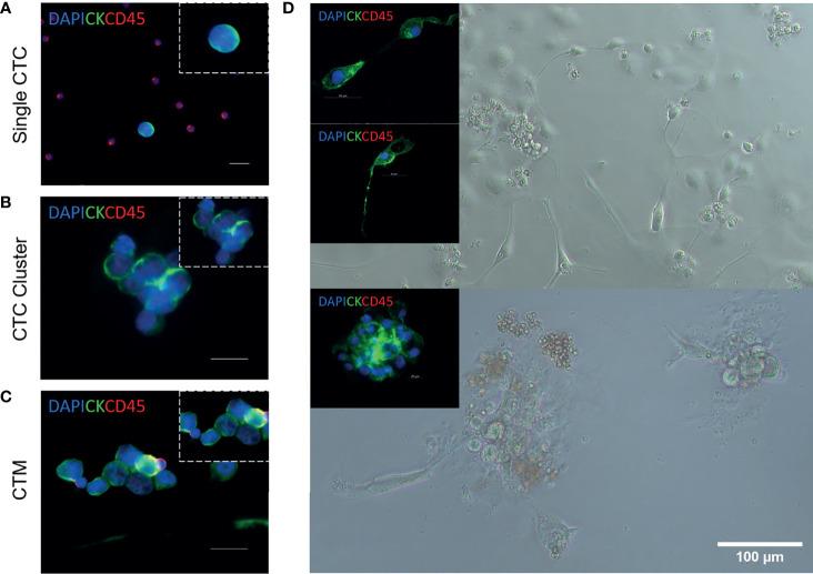 https://cdn.ncbi.nlm.nih.gov/pmc/blobs/8abc/8965052/35eeddffaca3/fonc-12-859152-g002.jpg