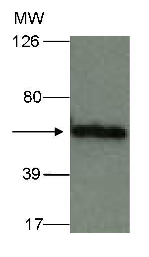 https://cdn.ncbi.nlm.nih.gov/pmc/blobs/8aca/2824641/b7b001d4041e/1743-422X-7-21-3.jpg