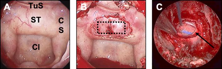 https://cdn.ncbi.nlm.nih.gov/pmc/blobs/8aca/9846073/133c62a6b60f/fonc-12-1067312-g001.jpg