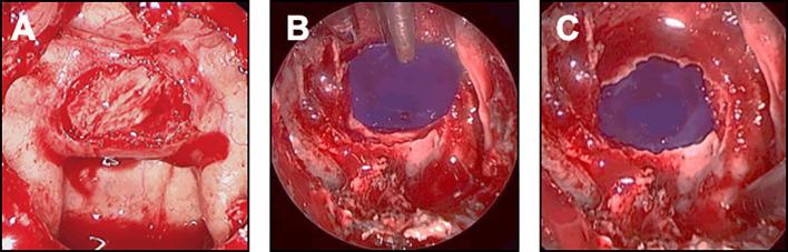 https://cdn.ncbi.nlm.nih.gov/pmc/blobs/8aca/9846073/9cd9d79484fc/fonc-12-1067312-g003.jpg