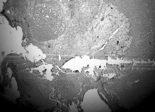https://cdn.ncbi.nlm.nih.gov/pmc/blobs/8ad5/3016193/b113bf79ee39/jsls-12-2-194-g05.jpg