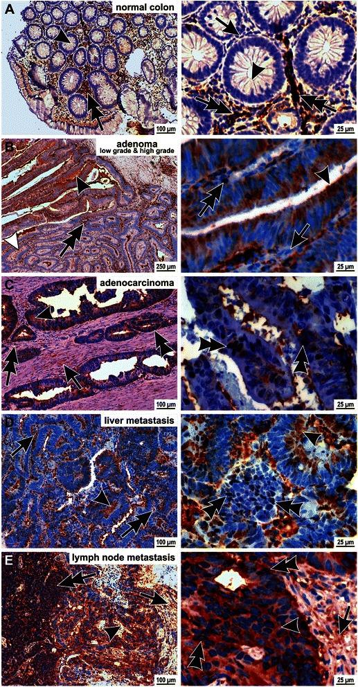 https://cdn.ncbi.nlm.nih.gov/pmc/blobs/8ada/4612562/b821823b1f66/12885_2015_1645_Fig1_HTML.jpg