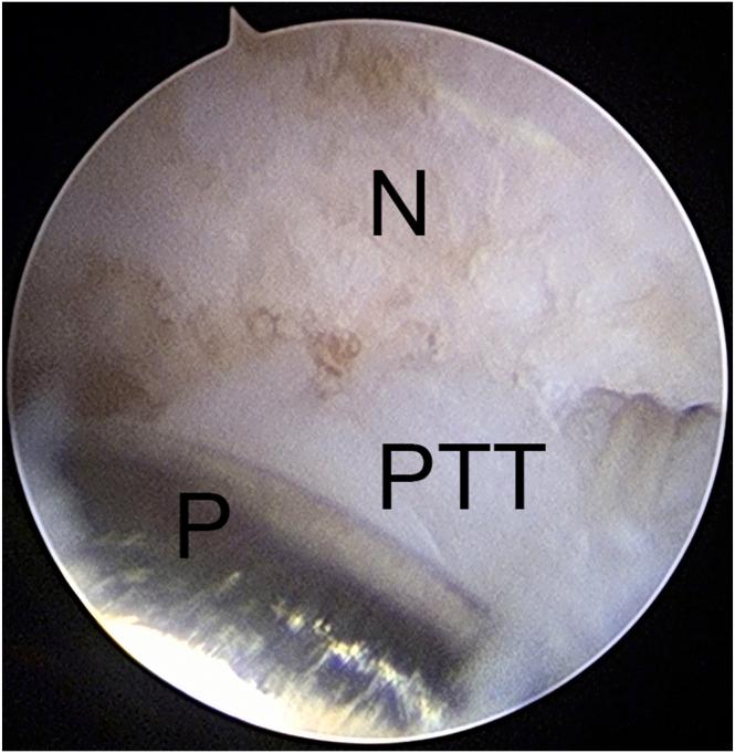 https://cdn.ncbi.nlm.nih.gov/pmc/blobs/8ae5/11144844/e6f3c07a9047/gr8.jpg