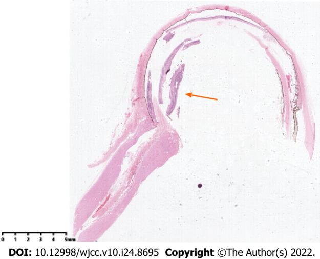 https://cdn.ncbi.nlm.nih.gov/pmc/blobs/8ae7/9453347/9855d8f1e5b8/WJCC-10-8695-g008.jpg