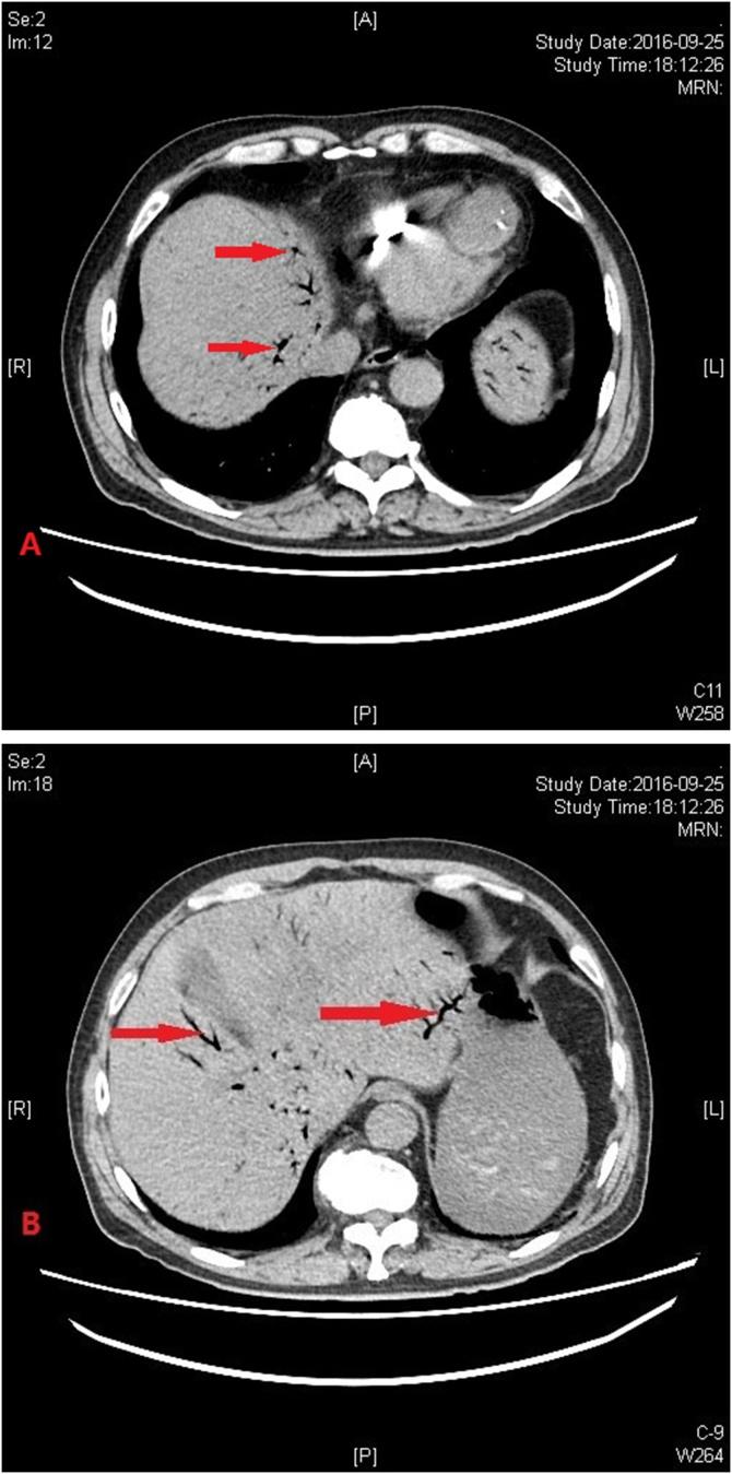 https://cdn.ncbi.nlm.nih.gov/pmc/blobs/8aec/5928029/0d5137367187/gr1.jpg