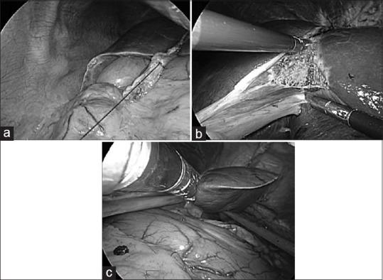 https://cdn.ncbi.nlm.nih.gov/pmc/blobs/8aed/7440003/c8c3acb3859c/JMAS-16-220-g002.jpg