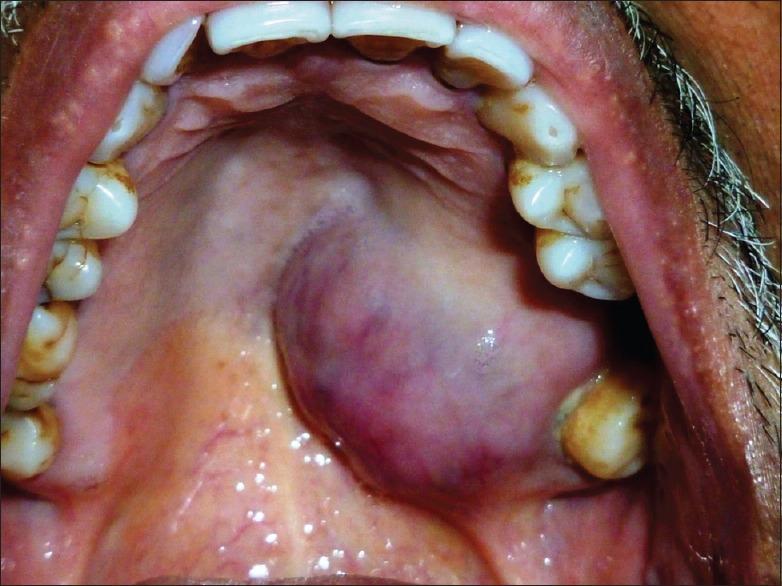 https://cdn.ncbi.nlm.nih.gov/pmc/blobs/8af4/4611942/6fccec9f3122/JOMFP-19-266b-g001.jpg