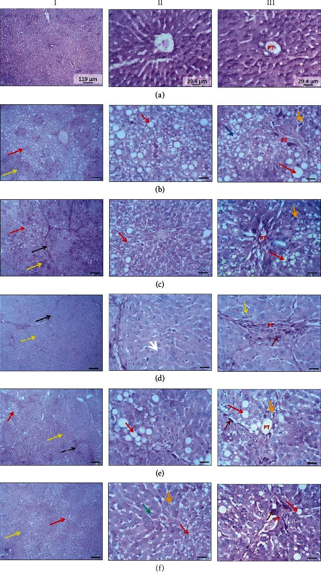 https://cdn.ncbi.nlm.nih.gov/pmc/blobs/8afb/10776197/dc24823b6284/BMRI2024-6673550.003.jpg
