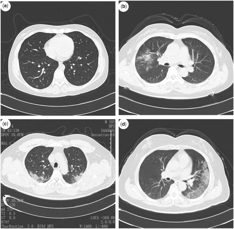 https://cdn.ncbi.nlm.nih.gov/pmc/blobs/8afd/7337188/c340d713784a/hcaa089f2.jpg