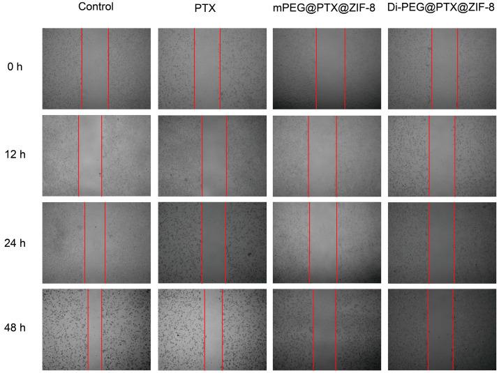 https://cdn.ncbi.nlm.nih.gov/pmc/blobs/8b06/10383971/81f1d1204214/pharmaceutics-15-01874-g006.jpg